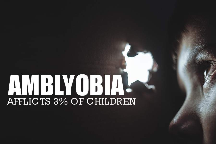 Amblyopia | Causes and Treatments